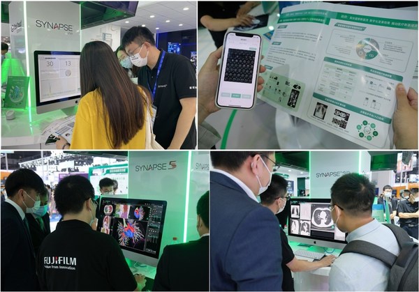 医学胶片怎么处理富士胶片智慧诊疗综合解决方案全新亮相CMEF 2021_https://www.jmylbn.com_新闻资讯_第3张