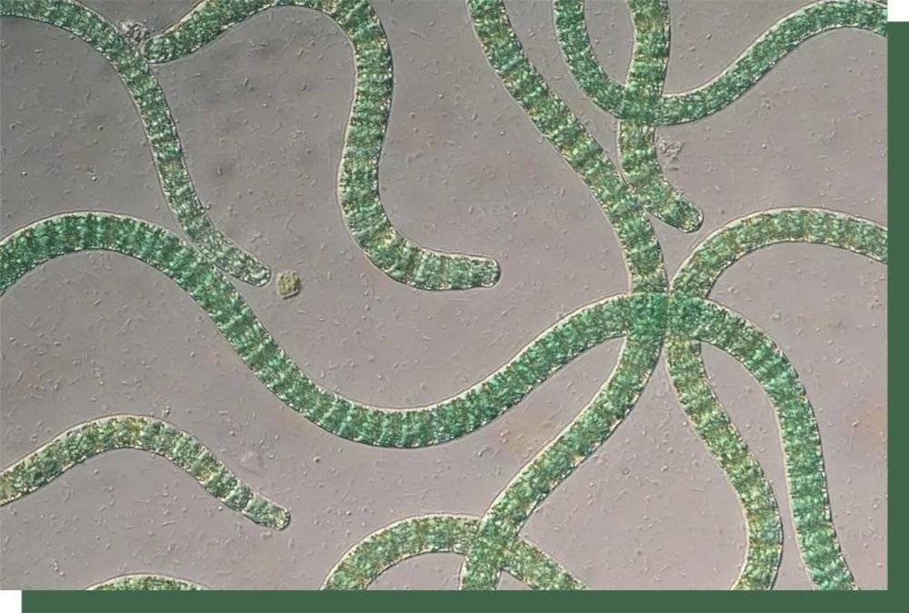 显微镜下的螺旋藻,本质上是一种呈现螺旋状的低等植物.08 google.