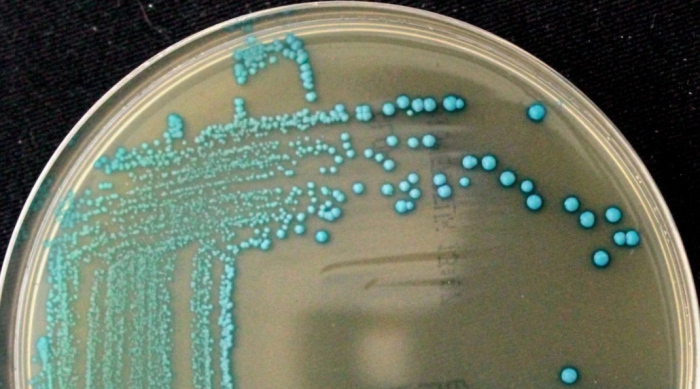科学家发现新的李斯特菌菌种  并呼吁修改食品安全检测方法