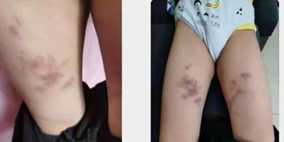 【8点见】致4死3伤,大连劳动公园肇事司机已被抓获