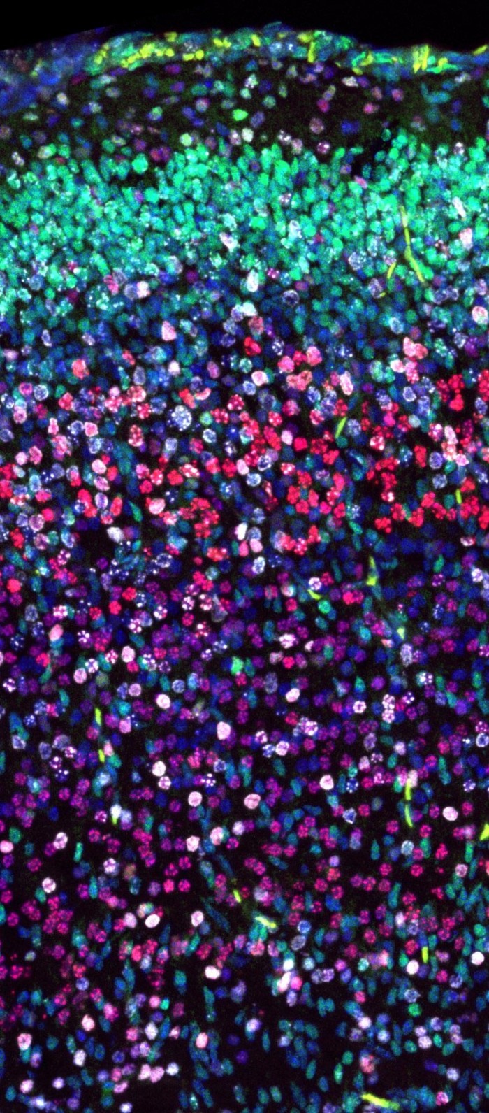 免疫荧光染色使科学家能够研究小鼠大脑中迁移的细胞（白色）