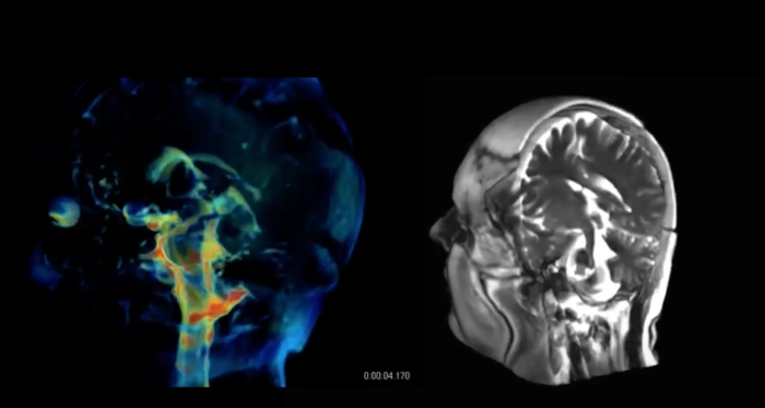 新成像技术将能提供极其详细的3D大脑脉动动画