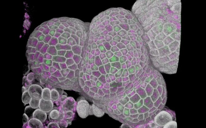 即将进行DNA复制（绿）和含有KRP4蛋白（红）的分生组织细胞（图片来源：John Innes Centre）