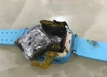 泉州一女童被电话手表严重烧伤 网友：不建议买杂牌手表