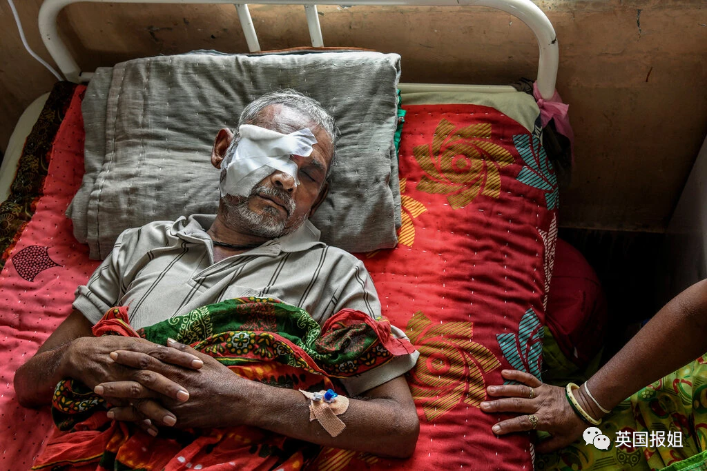 3万人感染,面部流血摘眼切鼻难保命|霉菌|印度|新冠肺炎_新浪新闻