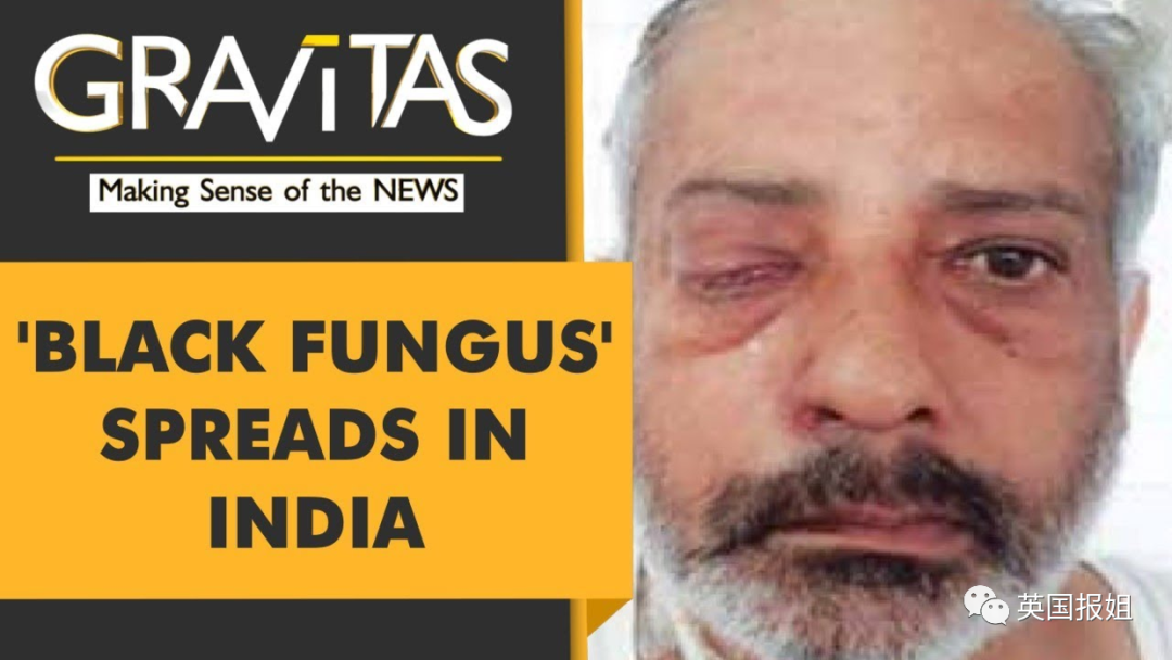 3万人感染,面部流血摘眼切鼻难保命|霉菌|印度|新冠肺炎_新浪新闻