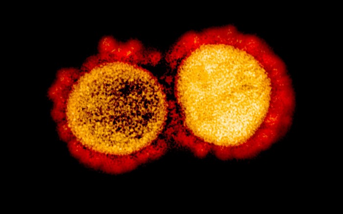 由人肺球状细胞制成的纳米混合物可以与SARS-CoV-2病毒结合并实现中和