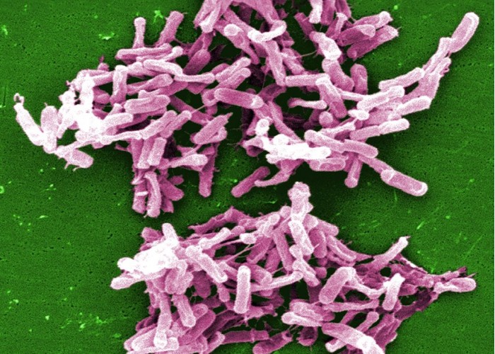 [图]科学家发现致病性肠道细菌和低热量饮食存在关联