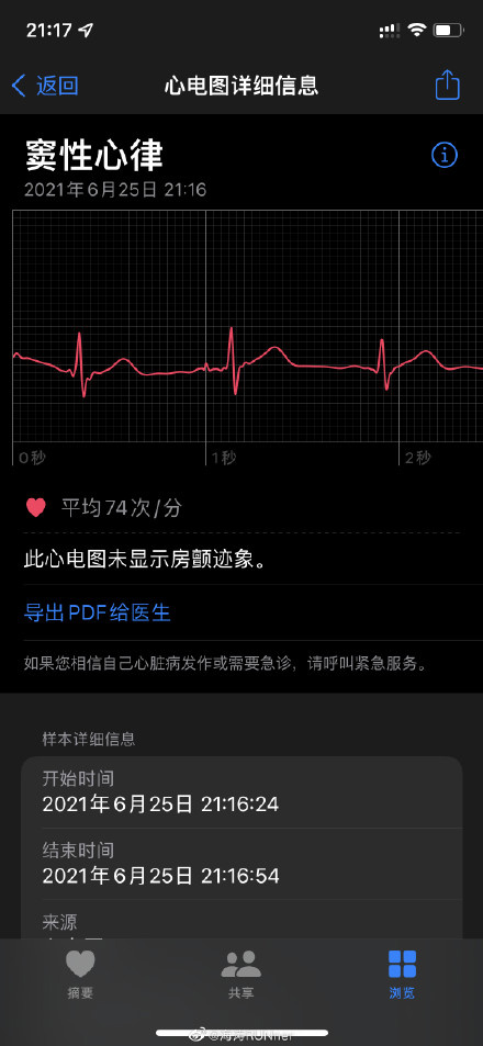 如果启用服务后,可以在apple watch上做心电图,"心电图app使用apple