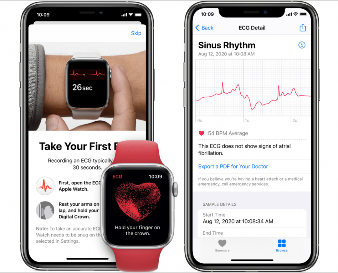 国行applewatch的心电图获批了但功能恐怕没那么强大
