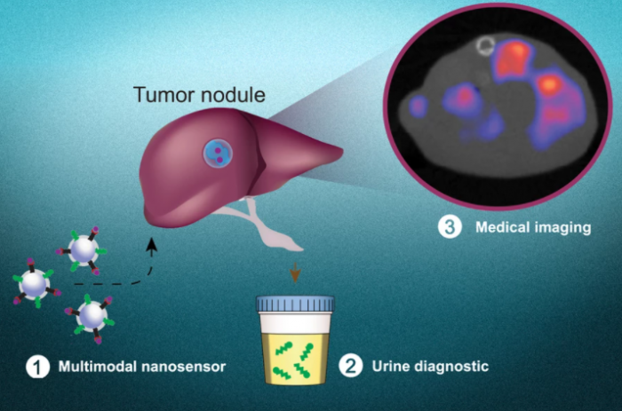 MIT科学家开发纳米粒子尿液测试 可诊断癌症并确定其位置