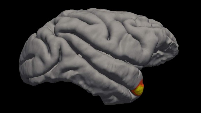 大脑中负责记忆面孔的神经元已被确认