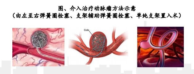 术和栓塞术,从而治疗病变血管,包括血管内弹簧圈栓塞术,凝块取出支架
