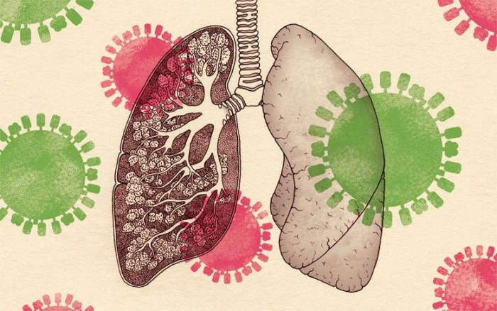 科学家发现负责调节流感对肺部破坏的分子  为保护肺部免受损害提供新希望