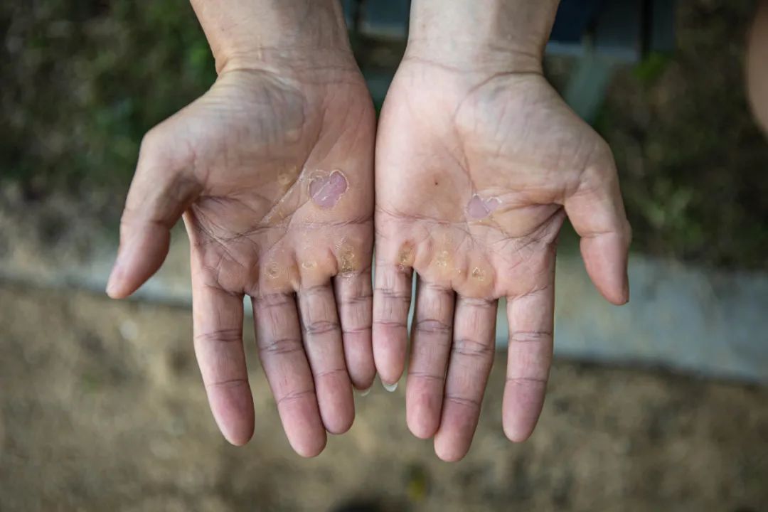 拉单杠前的双手