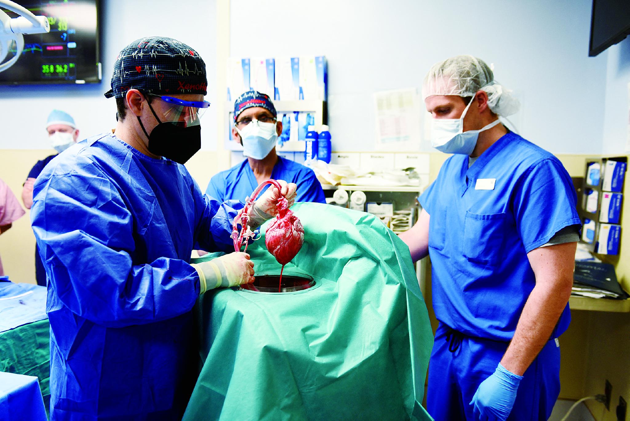 医生为换心患者移植手术做准备.