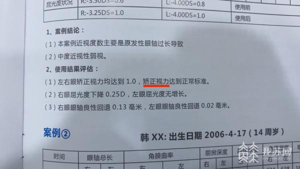 另外在明亮眼科诊所里也贴着很多病例情况介绍,宣称孩子们在使用哺光