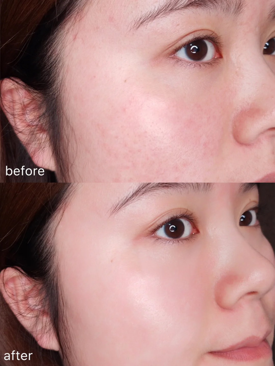 代替乳液 面霜 精华,相当于"浓缩型护肤",可以密集修护各种肌肤问题