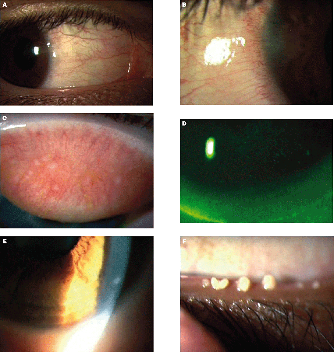 为什么美国的医疗器械注册叫做510k3N隐形眼镜还原仪已通过FDA 510K认证_https://www.jmylbn.com_新闻资讯_第3张