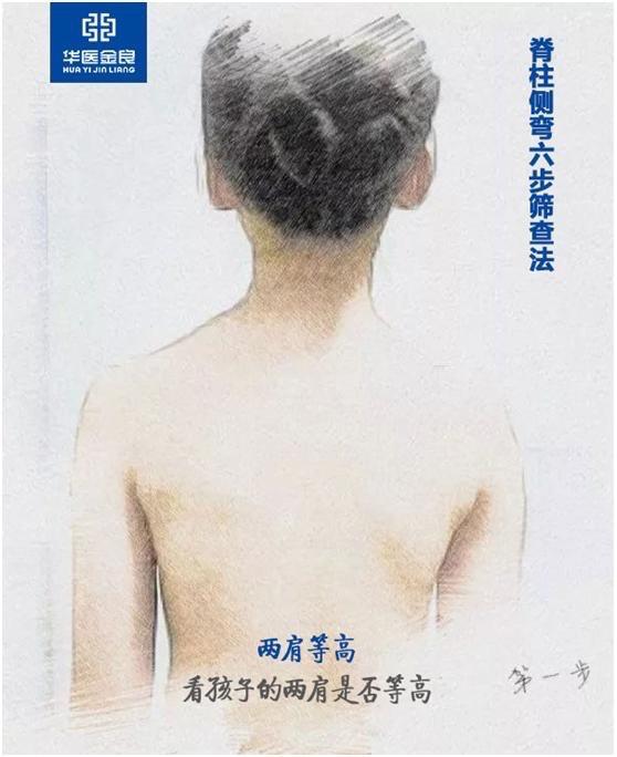 14岁女生背部植入20根长钉居然有这么多孩子脊柱侧弯