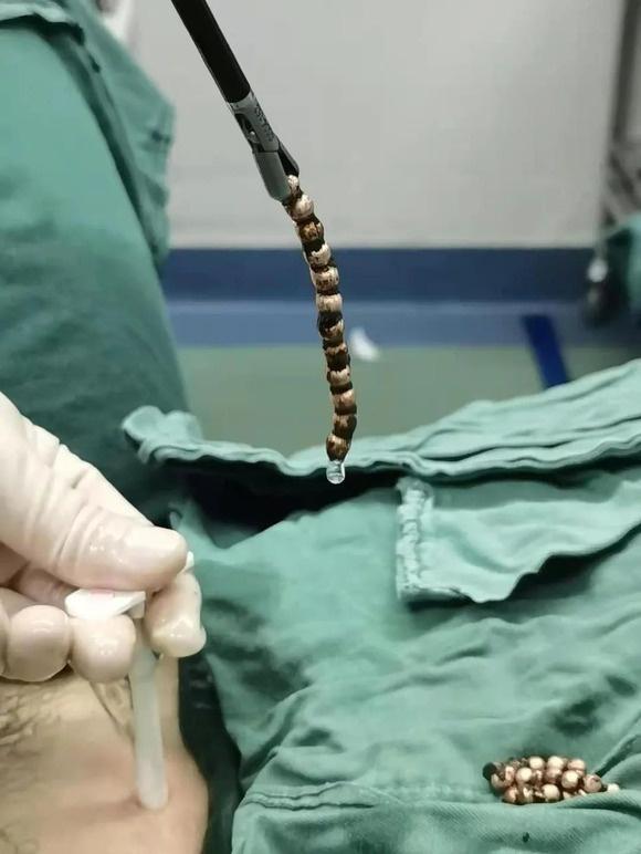 近年来,接诊过的尿道膀胱异物患者不在少数.