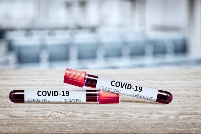 核酸用什么试剂鉴定首批自测试剂盒来了！抗原检测对无症状有用吗？还用去医院测核酸吗？_https://www.jmylbn.com_新闻资讯_第3张