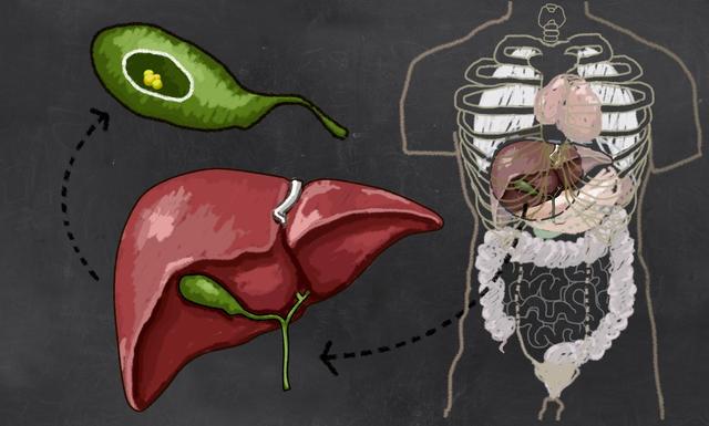 试想,要不是及时发现并切除胆囊,胆囊癌在所有肿瘤中恶性程度极高,王