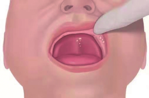马牙口腔图片