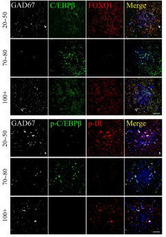 c/ebpb 调节人脑神经细胞中胰岛素及foxo信号,以及调控生命周期