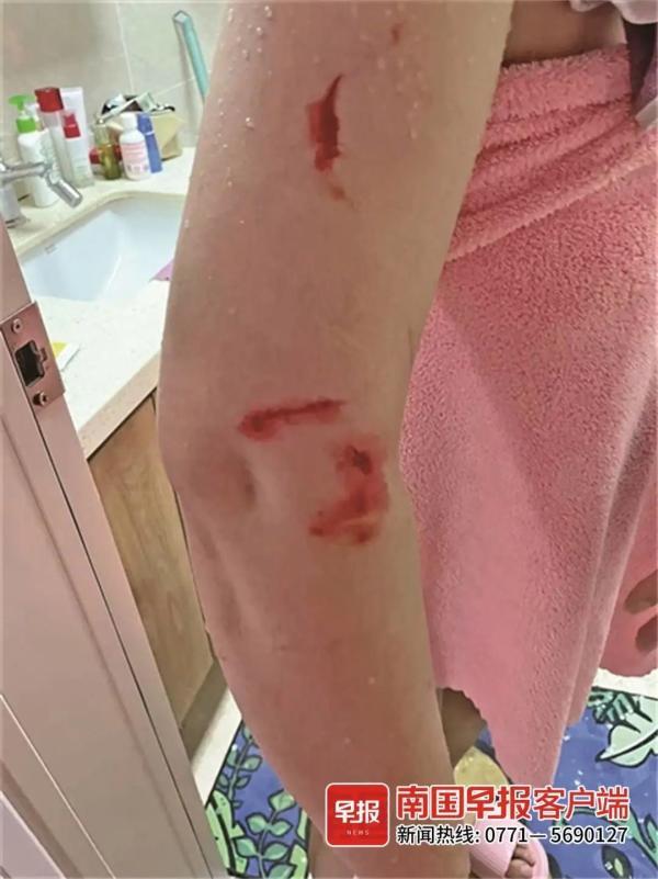 小区交房两年精装房浴室玻璃频爆裂有业主被划伤开发商称