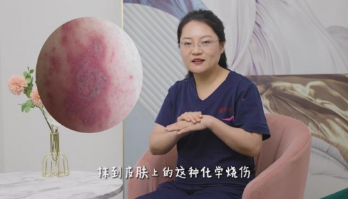喜报 西安国际医学整形医院杨艳萍主任 隐翅虫皮炎科普获奖|皮炎|皮肤