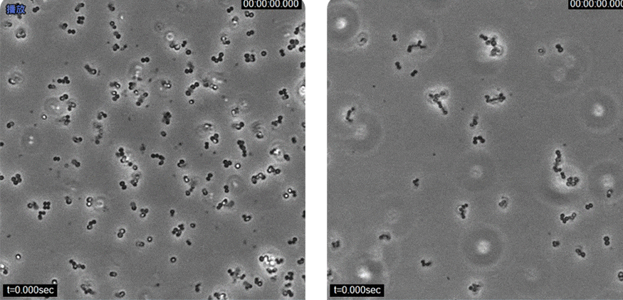 （普通鞋垫 vs 骆柒柒除臭鞋垫）