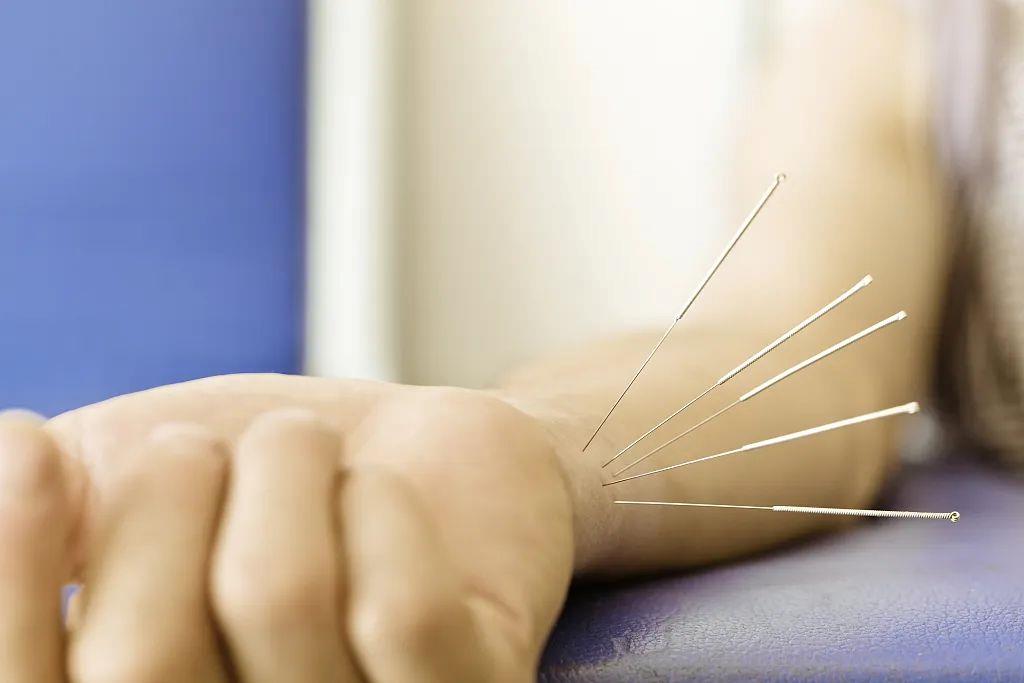 也可以采取针灸的方式如腱鞘炎,腱鞘囊肿实际上,慢性损伤其次是腕关节