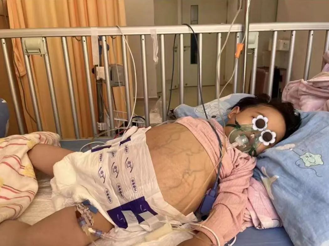 长兴3岁大肚女孩急需换肝活命请您献爱心为生命接力