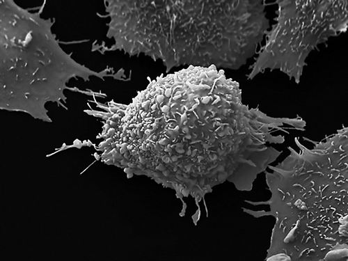 最大规模全基因组测序发现致癌新突变