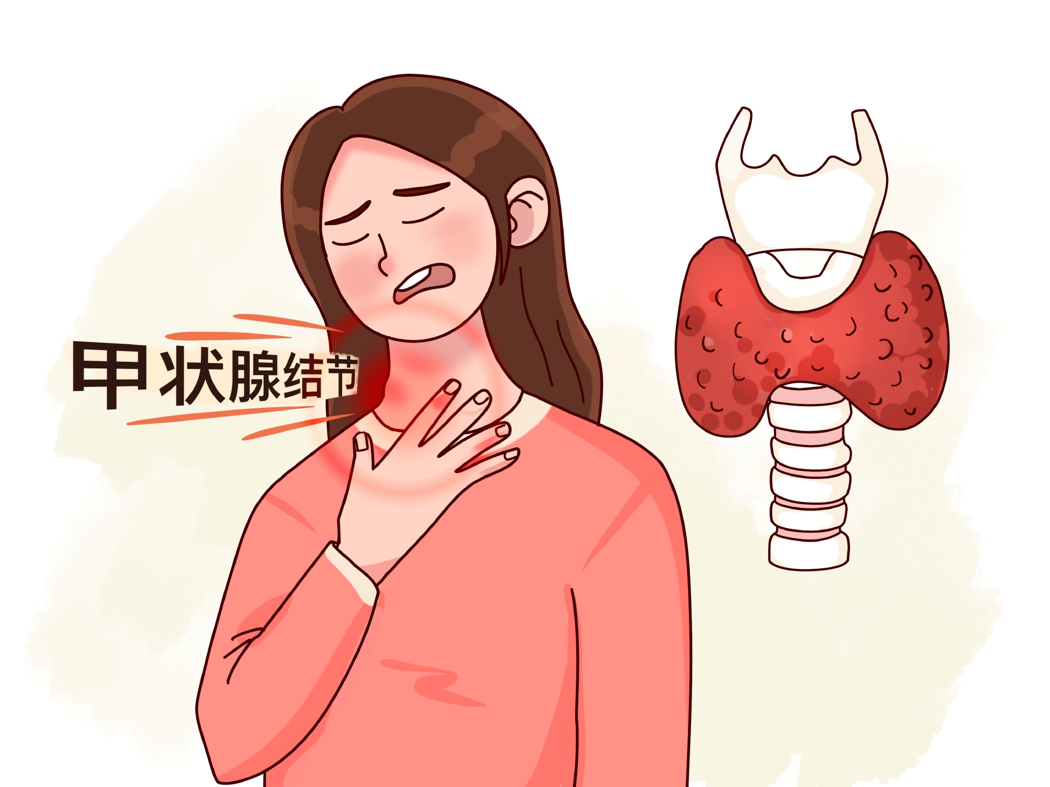 什么人容易长结节?哪种会癌变?专家:长这样的要担心!