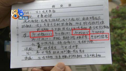 照片显示,王女士这颗牙齿上有一条细长的线状痕迹,牙科诊所的病历上写