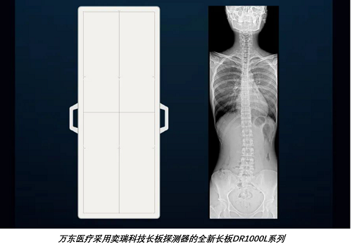 万东dr怎么样万东医疗：2021年DR销量1463套，市场份额远低于医招采数据统计_https://www.jmylbn.com_新闻资讯_第5张
