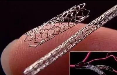 可以植入人体血管的钛合金支架
