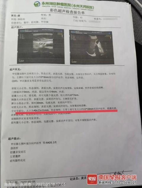 42岁男子体检报告单显示肚里有子宫
