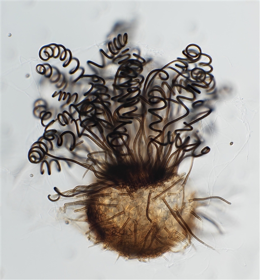 黑顶毛枝霉Trichocladium acropullum 受访者供图