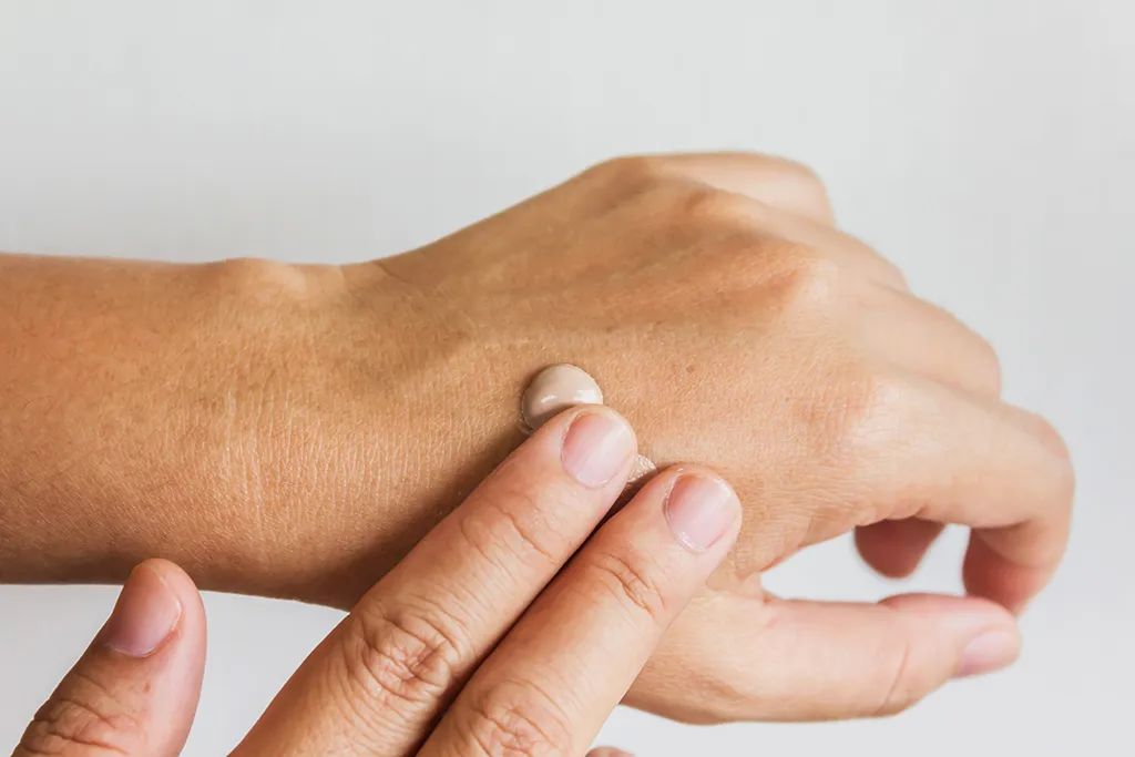 随意涂抹激素药膏看完别再乱用了