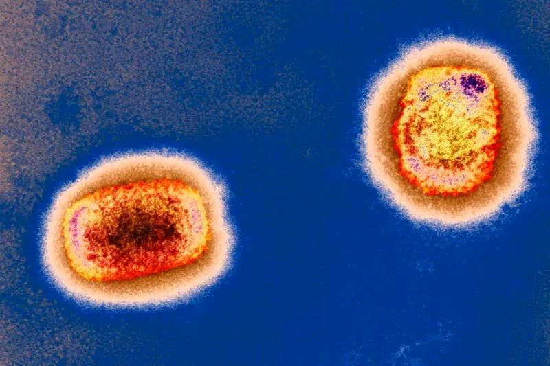 彩色透射电子显微捕获的猴痘病毒颗粒,源自英国《新科学家》