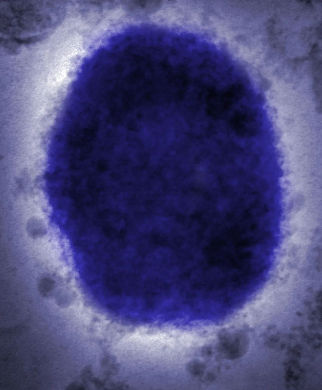 电子显微镜下的猴痘病毒 图片来源：视觉中国-VCG41N758292709