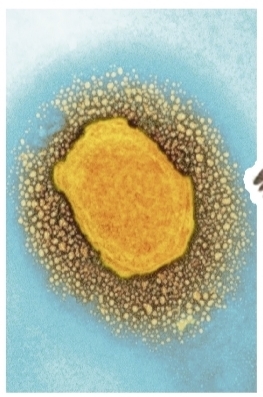 猴痘病毒（资料图片）。