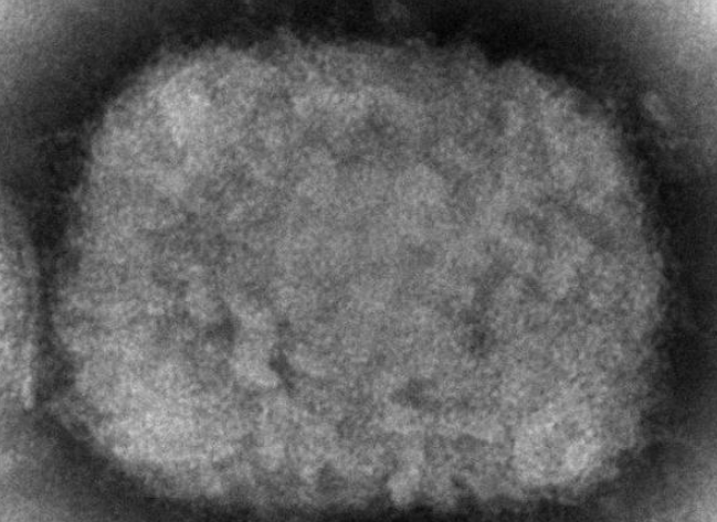 美国15州已发现45例猴痘病例 白宫再订购50万剂疫苗
