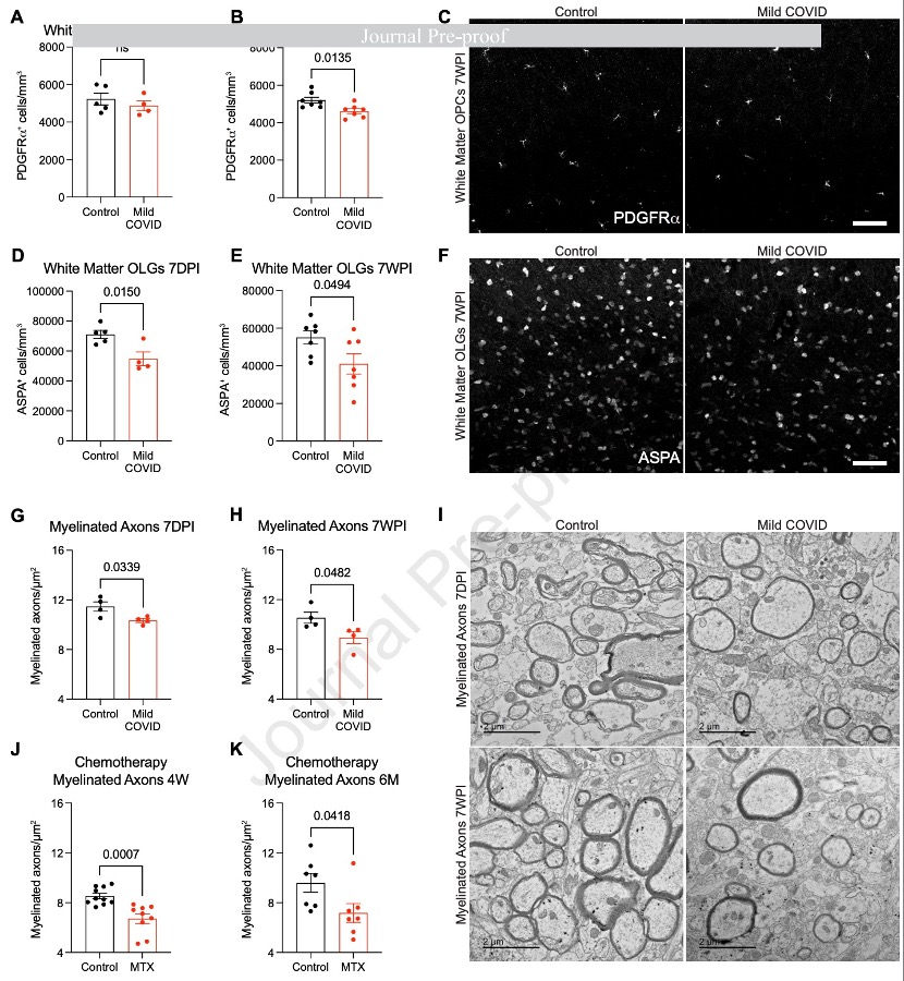 IT|斯坦福、耶鲁研究：新冠感染轻症仍可能导致神经细胞和髓鞘失调