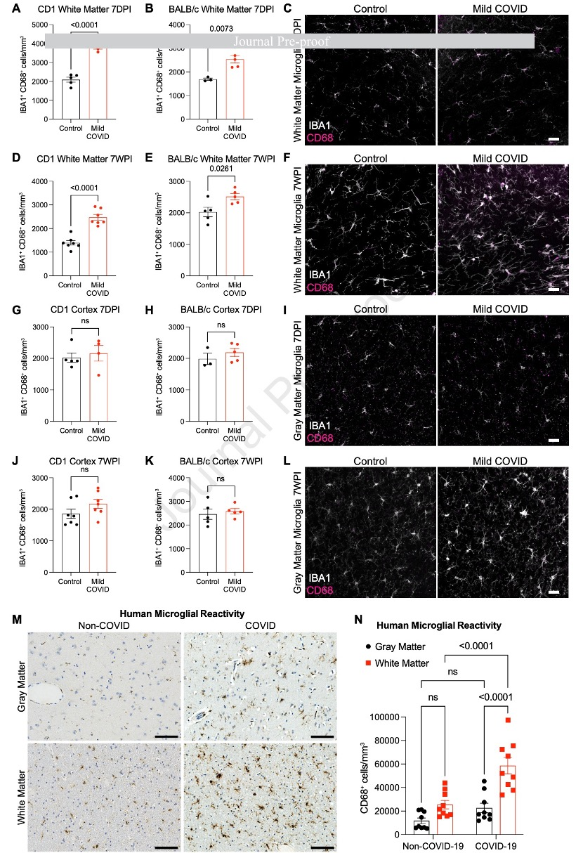 IT|斯坦福、耶鲁研究：新冠感染轻症仍可能导致神经细胞和髓鞘失调
