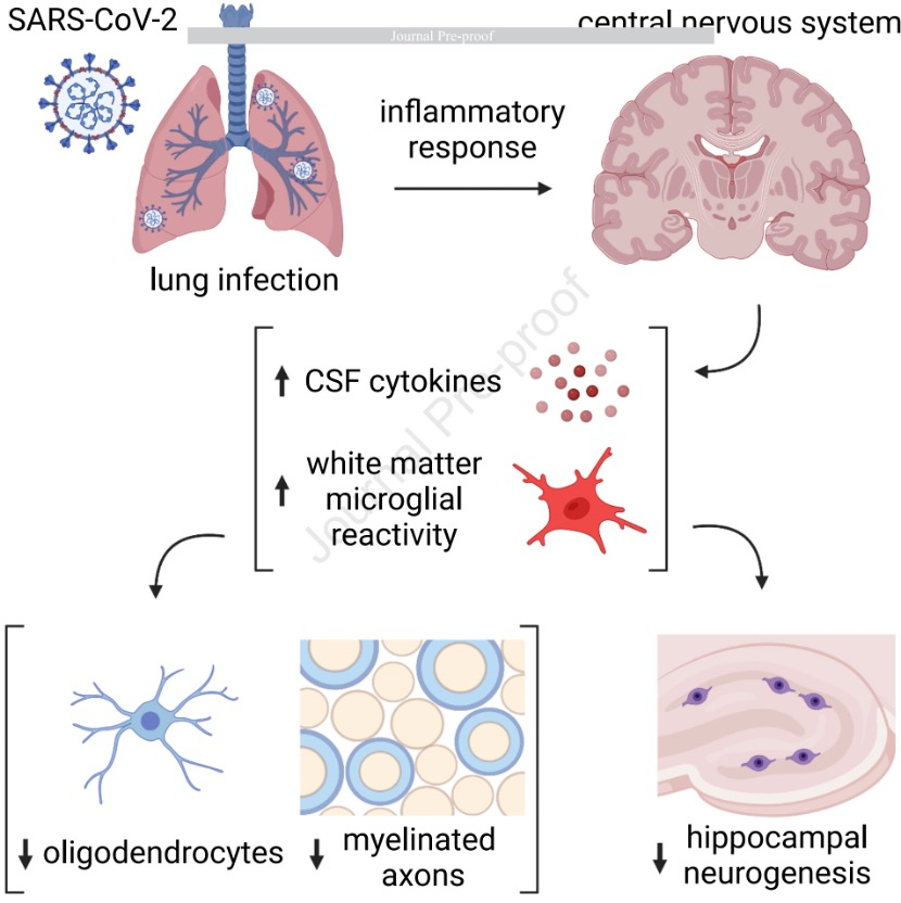 IT|斯坦福、耶鲁研究：新冠感染轻症仍可能导致神经细胞和髓鞘失调