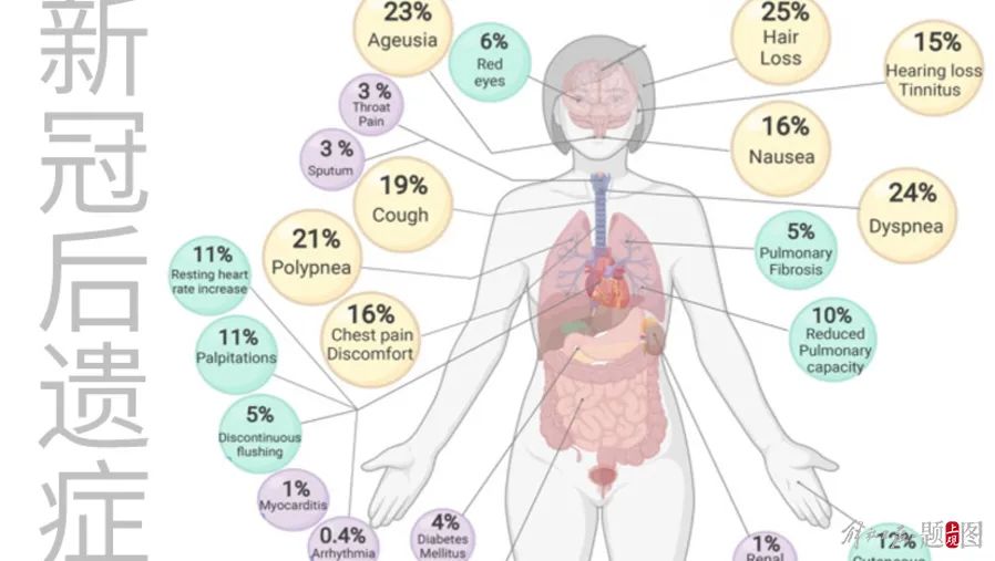 IT|长期症状风险比德尔塔低 全球首个奥密克戎后“长期新冠”研究发表